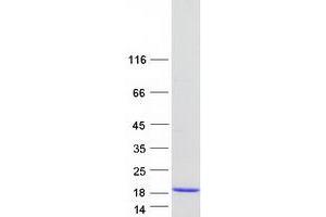 Western Blotting (WB) image for Chibby Homolog 1 (CBY1) (Transcript Variant 1) protein (Myc-DYKDDDDK Tag) (ABIN2713268)