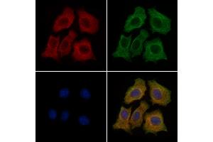ABIN6260006 and ABIN6279136 staining HepG2 cells by IF/ICC. (AQP11 Antikörper  (Internal Region))