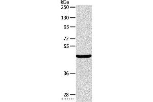 Western blot analysis of Mouse pancreas tissue, using ALKBH1 Polyclonal Antibody at dilution of 1:400 (ALKBH1 Antikörper)