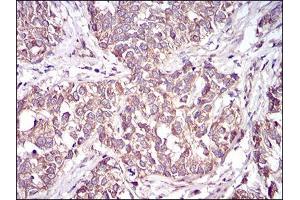 Immunohistochemistry (IHC) image for anti-CD36 (CD36) (AA 30-130) antibody (ABIN5542648)