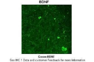 Sample Type :  Rhesus macaque spinal cord  Primary Antibody Dilution :  1:300  Secondary Antibody :  Donkey anti Rabbit 488  Secondary Antibody Dilution :  1:500  Color/Signal Descriptions :  Green: BDNF  Gene Name :  BDNF  Submitted by :  Timur Mavlyutov, Ph. (BDNF Antikörper  (Middle Region))