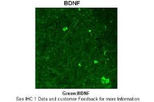 Sample Type :  Rhesus macaque spinal cord  Primary Antibody Dilution :  1:300  Secondary Antibody :  Donkey anti Rabbit 488  Secondary Antibody Dilution :  1:500  Color/Signal Descriptions :  Green: BDNF  Gene Name :  BDNF  Submitted by :  Timur Mavlyutov, Ph. (BDNF Antikörper  (Middle Region))