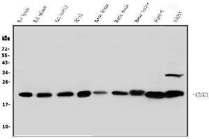 Western blot analysis of HP1 gamma using anti-HP1 gamma antibody (ABIN5693033). (CBX3 Antikörper  (AA 2-183))