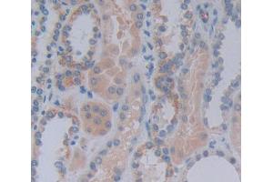 Used in DAB staining on fromalin fixed paraffin- embedded Kidney tissue (Acylphosphatase 1, Erythrocyte (AA 1-99) Antikörper)