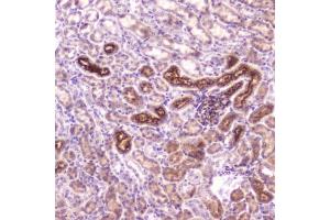 Immunohistochemistry (IHC) image for anti-Insulin-Like Growth Factor Binding Protein 2, 36kDa (IGFBP2) (AA 35-304) antibody (ABIN6654166)