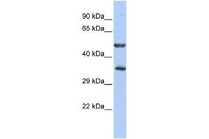 WB Suggested Anti-ZNF414 Antibody Titration:  0. (ZNF414 Antikörper  (N-Term))
