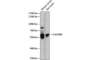 Western blot analysis of extracts of various cell lines, using C antibody (ABIN6130024, ABIN6137821, ABIN6137822 and ABIN6224970) at 1:1000 dilution. (CACNB4 Antikörper  (AA 401-520))