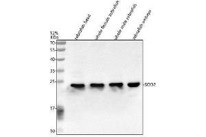 Western blot analysis of SOD2 using anti-SOD2 antibody (AZQ6P980).