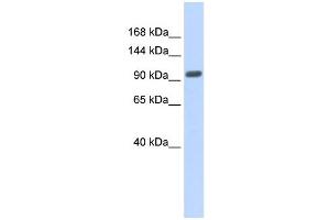 WB Suggested Anti-ZNF512B Antibody Titration: 0. (ZNF512B Antikörper  (Middle Region))