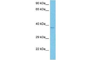 Host:  Rabbit  Target Name:  NOX4  Sample Tissue:  Human 786-0 Whole Cell  Antibody Dilution:  1ug/ml (NADPH Oxidase 4 Antikörper  (Middle Region))