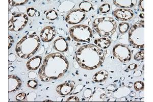 Immunohistochemical staining of paraffin-embedded Human liver tissue using anti-TBXAS1 mouse monoclonal antibody. (TBXAS1 Antikörper)