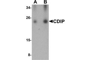 Western Blotting (WB) image for anti-LITAF-Like Protein (CDIP1) (Middle Region) antibody (ABIN1030904)