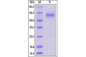 SDS-PAGE (SDS) image for Leukocyte-Associated Immunoglobulin-Like Receptor 1 (LAIR1) (AA 22-141) protein (Fc Tag) (ABIN5954988)