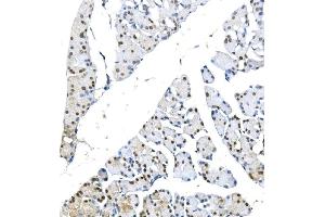 IHC analysis of METTL1 using anti-METTL1 antibody (ABIN7600484). (METTL1 Antikörper  (AA 2-276))