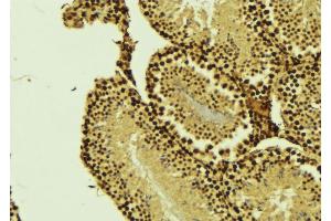 ABIN6276363 at 1/100 staining Mouse testis tissue by IHC-P. (CARD8 Antikörper)