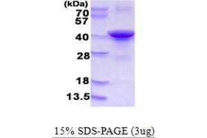 Low Density Lipoprotein Receptor Adaptor Protein 1 (LDLRAP1) (AA 1-308) protein (His tag)