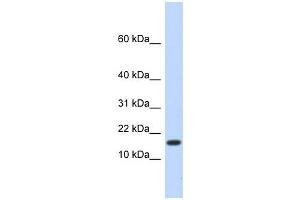 HERC4 antibody used at 1 ug/ml to detect target protein.