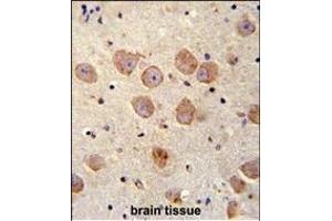 Immunohistochemistry (Paraffin-embedded Sections) (IHC (p)) image for anti-SKI Family Transcriptional Corepressor 2 (SKOR2) (AA 870-898), (C-Term) antibody (ABIN655936)