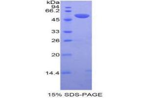 SDS-PAGE (SDS) image for Plasminogen Activator, Tissue (PLAT) (AA 311-562) protein (His tag,GST tag) (ABIN1877837)