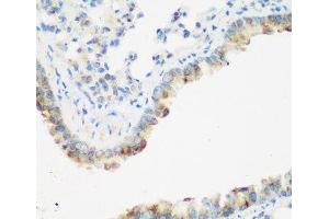Immunohistochemistry of paraffin-embedded Mouse lung using IGF2BP3 Polyclonal Antibody at dilution of 1:200 (40x lens). (IGF2BP3 Antikörper)