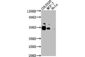 Western Blot Positive WB detected in: COLO320 whole cell lysate, MCF-7 whole cell lysate, Hela whole cell lysate All lanes: KRT20 antibody at 1:2000 Secondary Goat polyclonal to rabbit IgG at 1/50000 dilution Predicted band size: 49 kDa Observed band size: 49 kDa (Keratin 2 Antikörper  (AA 207-424))