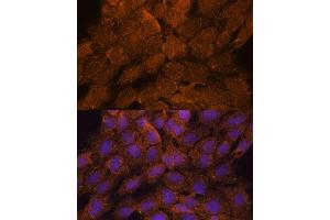 Immunofluorescence analysis of C6 cells using TNFL2 antibody (ABIN6133093, ABIN6149298, ABIN6149299 and ABIN6217788) at dilution of 1:100. (TNFAIP8L2 Antikörper  (AA 1-184))