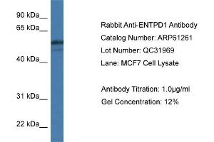 Western Blotting (WB) image for anti-Ectonucleoside Triphosphate diphosphohydrolase 1 (ENTPD1) (N-Term) antibody (ABIN2788738)