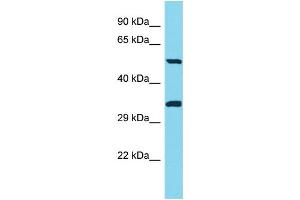 Host: Rabbit Target Name: PNLIPRP3 Sample Type: Jurkat Whole Cell lysates Antibody Dilution: 1. (PNLIPRP3 Antikörper  (C-Term))