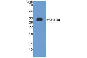 Western blot analysis of recombinant Human ITGb5. (Integrin beta 5 Antikörper  (AA 137-378))