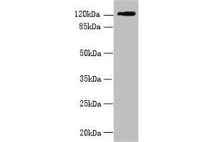 Western blot All lanes: SLC4A8 antibody at 2 μg/mL + Hela whole cell lysate Secondary Goat polyclonal to rabbit IgG at 1/10000 dilution Predicted band size: 123, 121, 118, 112, 78, 84, 72 kDa Observed band size: 123 kDa (SLC4A8 Antikörper  (AA 1-300))