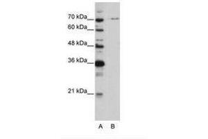 Image no. 1 for anti-PRP3 Pre-mRNA Processing Factor 3 Homolog (PRPF3) (AA 63-112) antibody (ABIN6736204) (PRPF3 Antikörper  (AA 63-112))