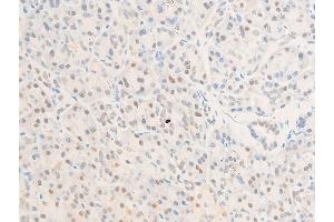 Immunohistochemistry (IHC) image for anti-Baculoviral IAP Repeat-Containing 5 (BIRC5) (pThr117) antibody (ABIN6255588)