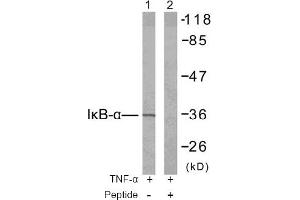 Image no. 2 for anti-Nuclear Factor of kappa Light Polypeptide Gene Enhancer in B-Cells Inhibitor, alpha (NFKBIA) (Tyr42) antibody (ABIN197391) (NFKBIA Antikörper  (Tyr42))