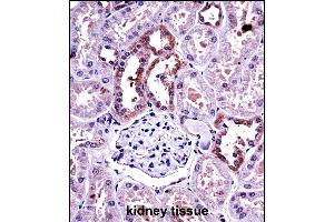 M-CSF Antibody (Center) ((ABIN390719 and ABIN2840996))immunohistochemistry analysis in formalin fixed and paraffin embedded human kidney tissue followed by peroxidase conjugation of the secondary antibody and DAB staining. (M-CSF/CSF1 Antikörper  (AA 230-257))