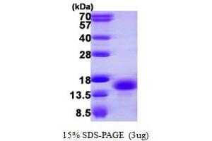 SDS-PAGE (SDS) image for Protein Kinase (CAMP-Dependent, Catalytic) Inhibitor beta (PKIB) (AA 1-78) protein (His tag) (ABIN667403)