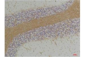 Immunohistochemistry (IHC) analysis of paraffin-embedded Rat Brain Tissue using GABA A Receptor alpha2 Rabbit Polyclonal Antibody diluted at 1:200. (GABRA2 Antikörper)
