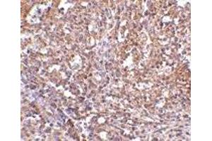 Immunohistochemistry (IHC) image for anti-ORAI Calcium Release-Activated Calcium Modulator 1 (ORAI1) (C-Term) antibody (ABIN1030562)
