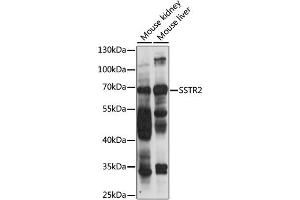 Western blot analysis of extracts of various cell lines, using SSTR2 antibody (ABIN6291365) at 1:1000 dilution.