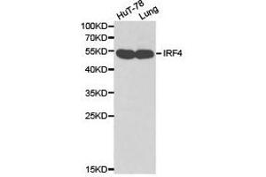 Western Blotting (WB) image for anti-Interferon Regulatory Factor 4 (IRF4) antibody (ABIN1873272) (IRF4 Antikörper)