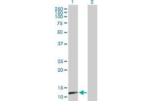 Western Blot analysis of NUDT8 expression in transfected 293T cell line by NUDT8 MaxPab polyclonal antibody. (NUDT8 Antikörper  (AA 1-140))