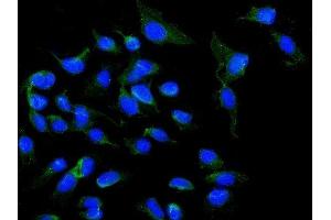 IF analysis of NOX5 using anti-NOX5 antibody (ABIN6719638). (NOX5 Antikörper  (AA 13-197))