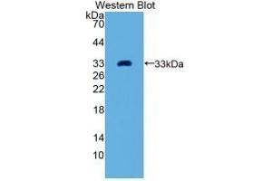 Detection of Recombinant GDF11, Human using Monoclonal Antibody to Growth Differentiation Factor 11 (GDF11) (GDF11 Antikörper  (AA 138-386))