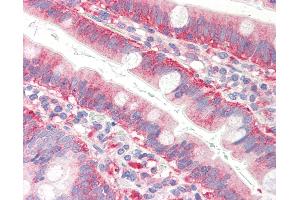 Anti-CFL1 / Cofilin antibody IHC of human small intestine.