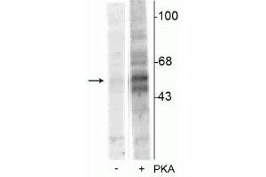 Western blot of recombinant tryptophan hydroxylase incubated in the absence (-) and presence (+) of cAMP-dependent protein kinase  showing specific immunolabeling of the ~55 kDa tryptophan hydroxylase protein phosphorylated at Ser58. (Tryptophan Hydroxylase 1 Antikörper  (pSer58))