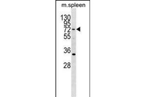 HIC2 Antibody (Center) (ABIN1538292 and ABIN2850037) western blot analysis in mouse spleen tissue lysates (35 μg/lane).