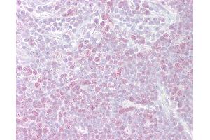 Anti-MCM3 antibody IHC of human thymus. (MCM3 Antikörper  (AA 726-775))