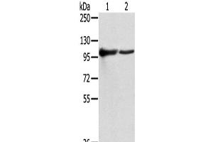 Western Blot analysis of K562 and A431 cells using TPX2 Polyclonal Antibody at dilution of 1/800 (TPX2 Antikörper)