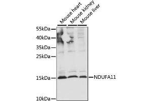 Western blot analysis of extracts of various cell lines, using NDUF antibody (ABIN7268798) at 1:1000 dilution. (NDUFA11 Antikörper  (AA 1-100))