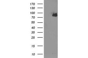 Western Blotting (WB) image for anti-Acyl-CoA Synthetase Short-Chain Family Member 2 (ACSS2) antibody (ABIN1496431) (ACSS2 Antikörper)