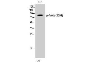 Western Blotting (WB) image for anti-P21-Activated Kinase 1 (PAK1) (pSer204) antibody (ABIN3173316) (PAK1 Antikörper  (pSer204))